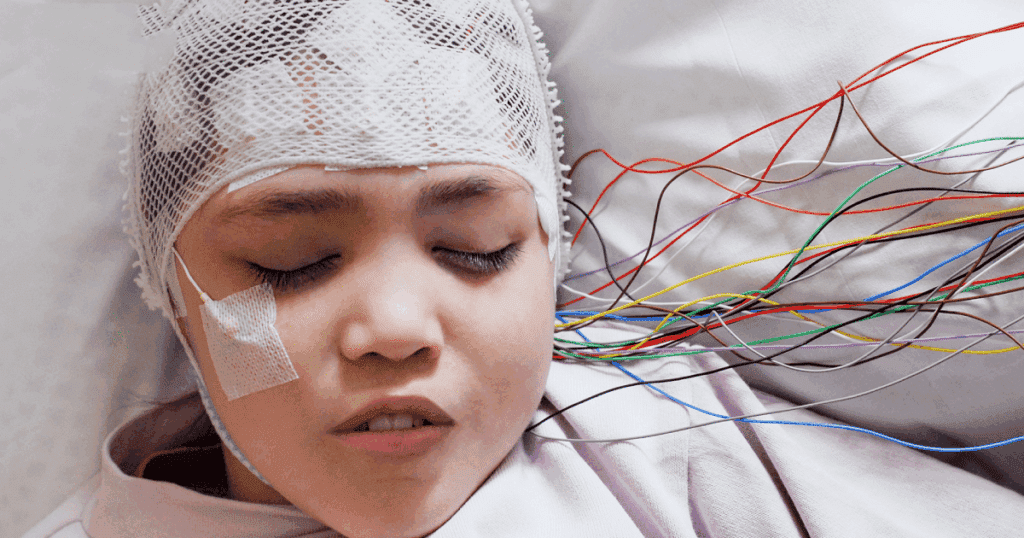 Épilepsie chez l'enfant