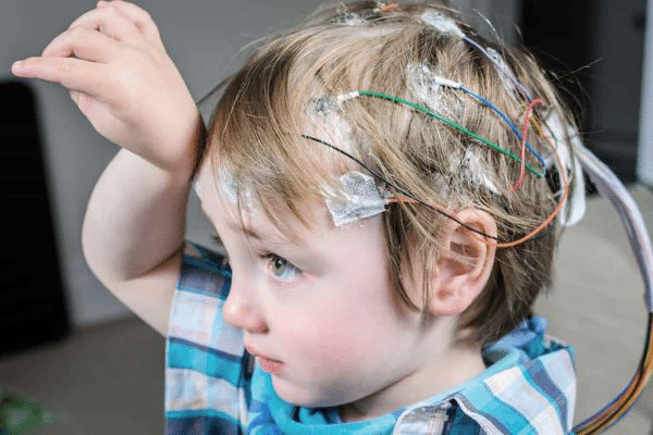 Épilepsie chez l'enfant