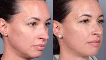 472531546 1128023085708375 7910718581619450640 n