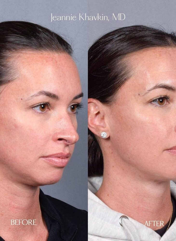 472531546 1128023085708375 7910718581619450640 n