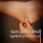 الوذمة الشحمية - الليبيديما