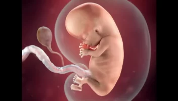 53444 20180128201720283