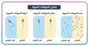 العقم عند الرجال