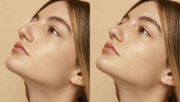 woman getting ready nose job surgery copy scaled