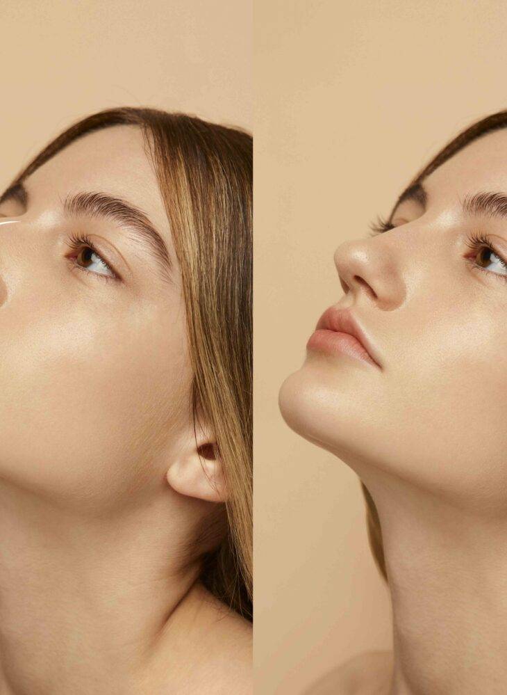 woman getting ready nose job surgery copy scaled