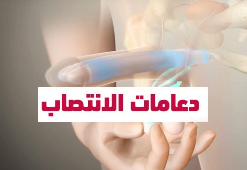 دعامات الانتصاب