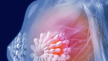 breast cancer treatment in jordan