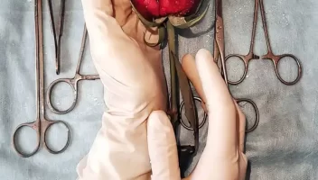 ما قبل الجراحة