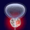 Prostate diseases