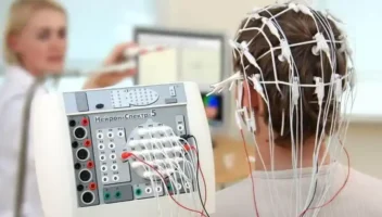 Electroencephalography