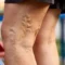 5 Best Exercises to Treat & Prevent Varicose Veins copy